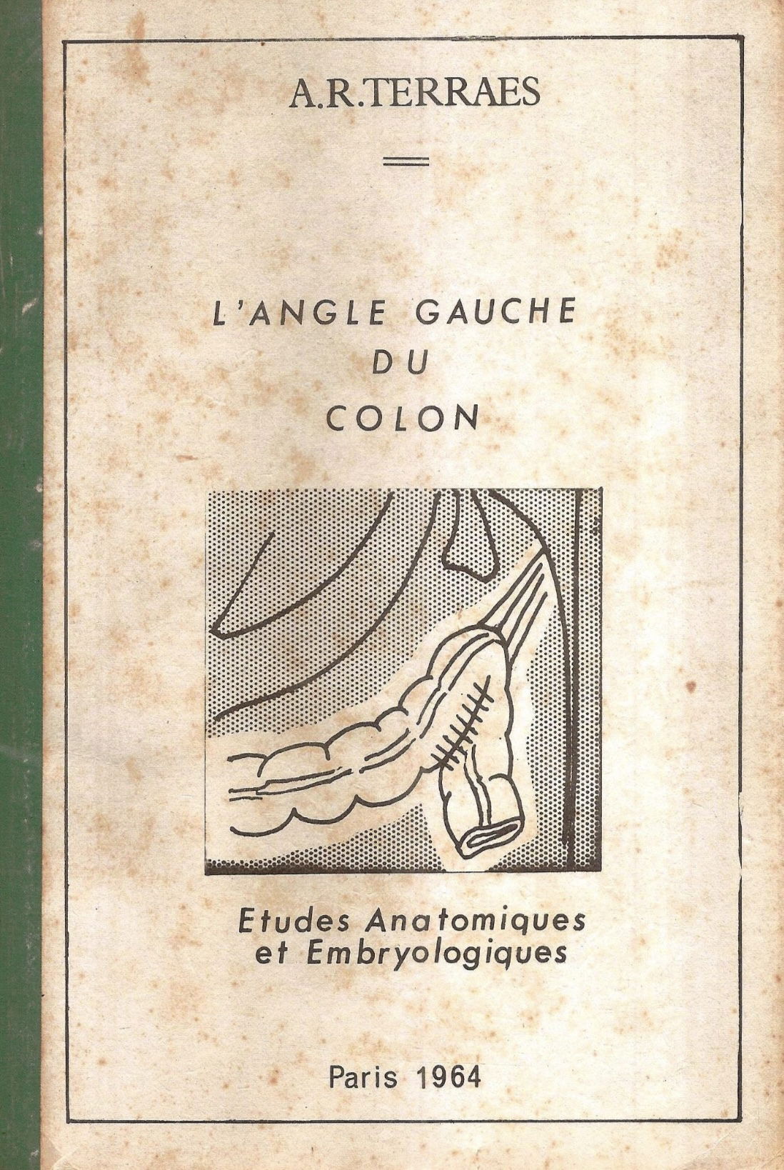 Tesis Doctoral: El Ángulo Izquierdo del Colon