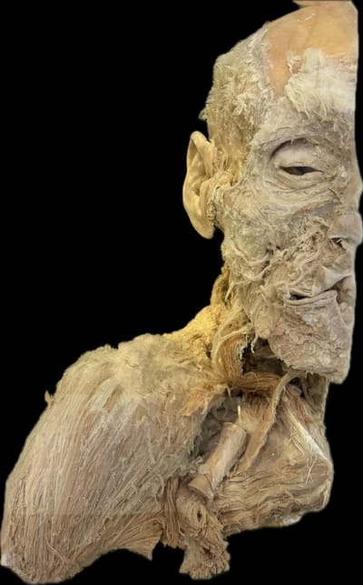 Corte Sagital de Cabeza y Cuello Derecho