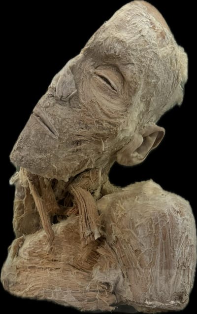 Corte Sagital de Cabeza y Cuello Izquierdo