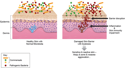 Skin Microbiome and Modern Skincare