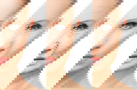 TYPES OF SKIN AGING AND SOLUTIONS TO AGE GRACEFULLY