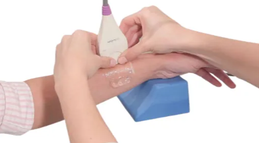 Bone Mineral Density Screening for HEDIS OMW/OSW