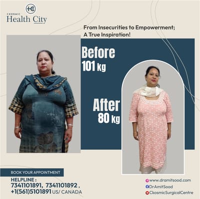 The Role of Bariatric Surgery in Treating Obesity-Related Conditions