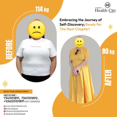 How to Avoid Weight Regain After Surgery