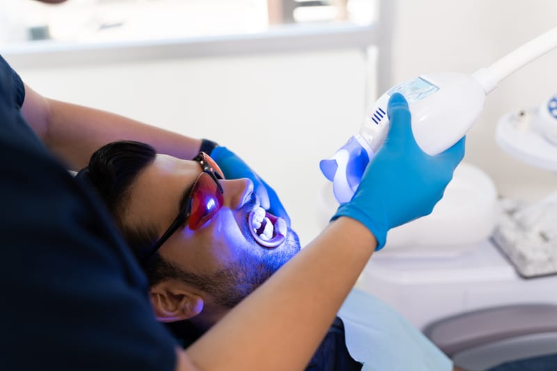 ✨️LASER TEETH WHITENING (Rs.16,000/-)