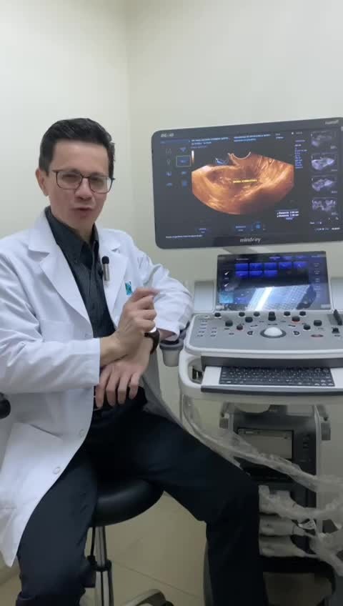 MIOMECTOMIA VIDEO HISTEROSCOPICA