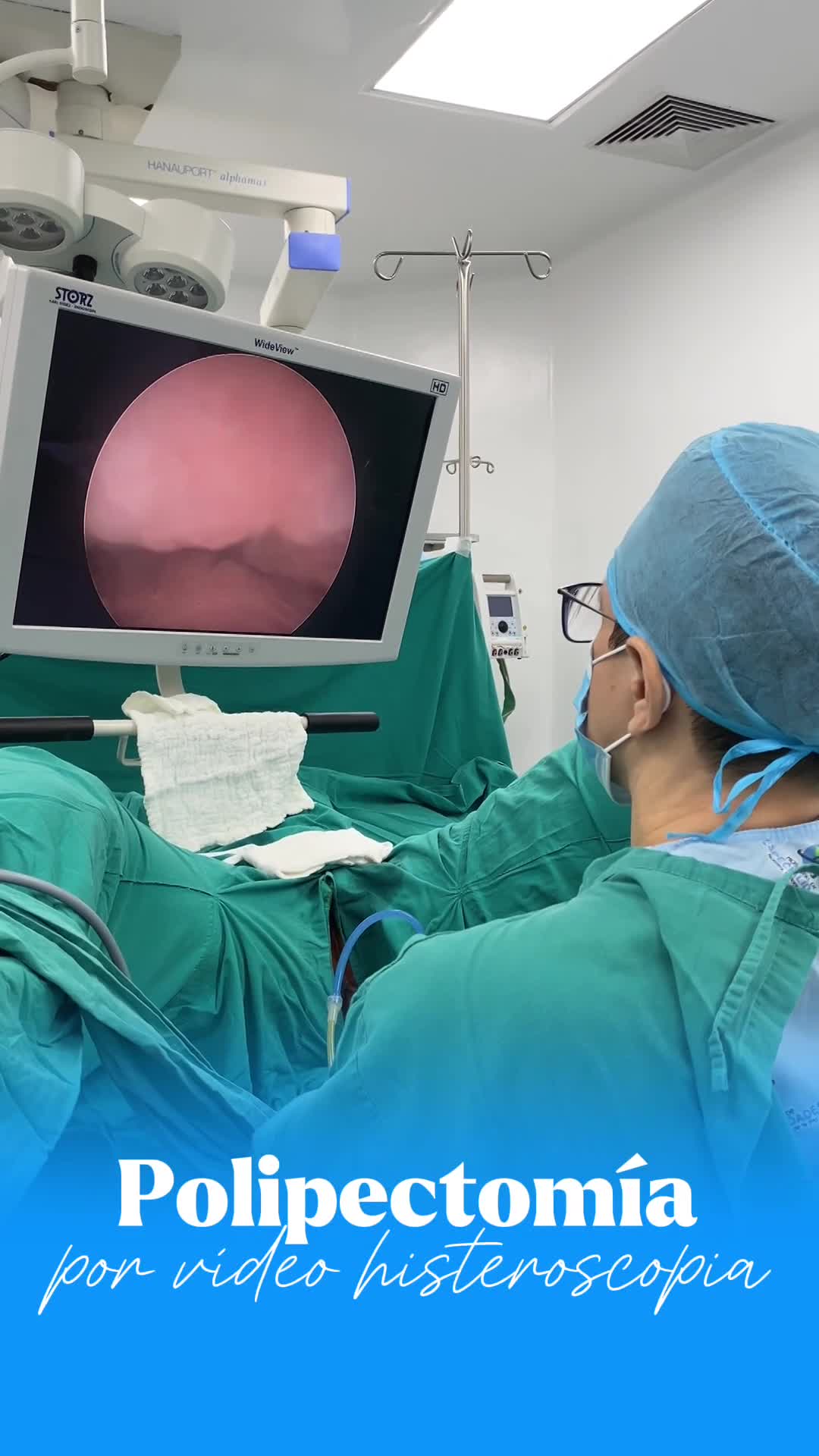 POLIPECTOMÍA HISTEROSCOPICA