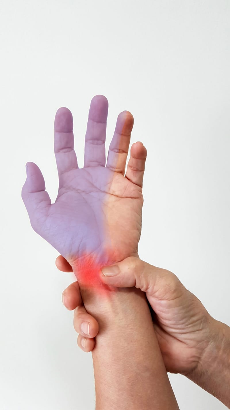 תסמונת התעלה הקרפלית Carpal Tunnel Syndrome