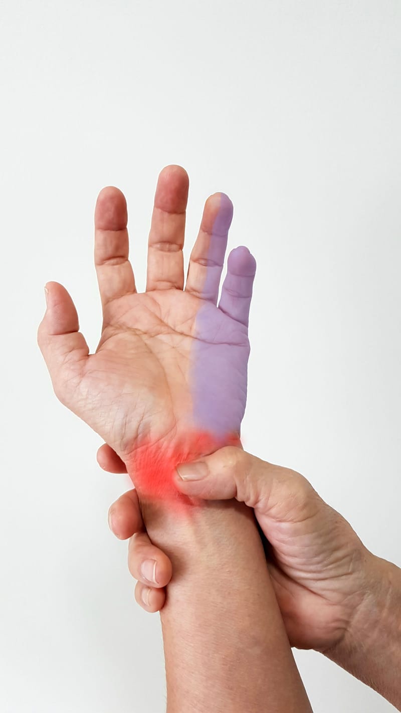 תסמונת התעלה הקוביטלית (Cubital Tunnel Syndrome)