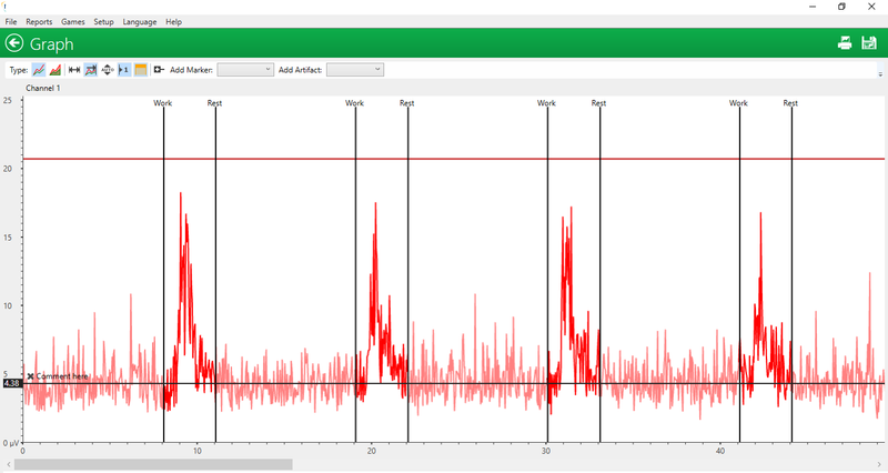 היעילות של טיפול באמצעות ביופידבק (biofeedback) בתסמונת האגן הכאוב הכרוני CPPS