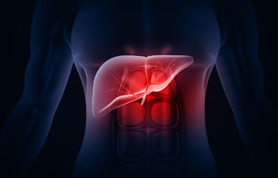 כבד שומני — המדריך המלא לטיפול נכון