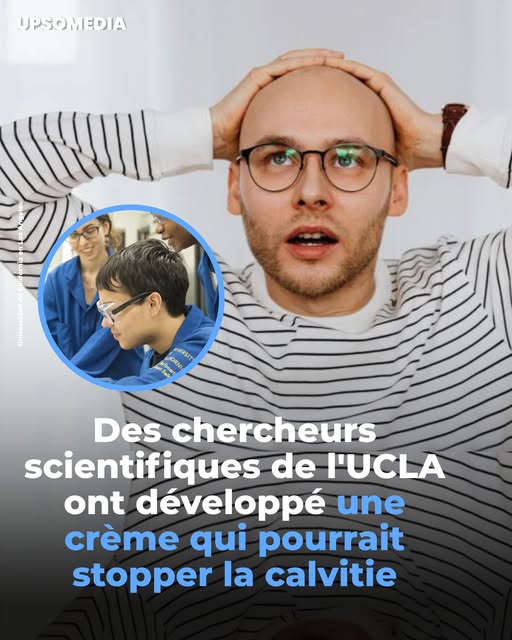 Une solution pour arrêter un début de calvitie