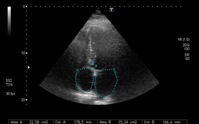 Los artefactos y sombras en las nuevas tecnologías artefactos y sombras en las nuevas tecnologías