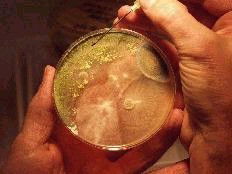 החלק החשוב ביותר בטיפול הוא מציאת אוכלוסיית פטריות עובש בבית (לרוב הן שוכנות במקומות עם לחות גבוהה) וכן וויסות אחוזי הלחות בתוך הבית. מומלץ אף לקחת דגימות אוויר על מנת לחשב את רמות הזיהום על ידי נבגי עובש בתוך מבני מגורים.