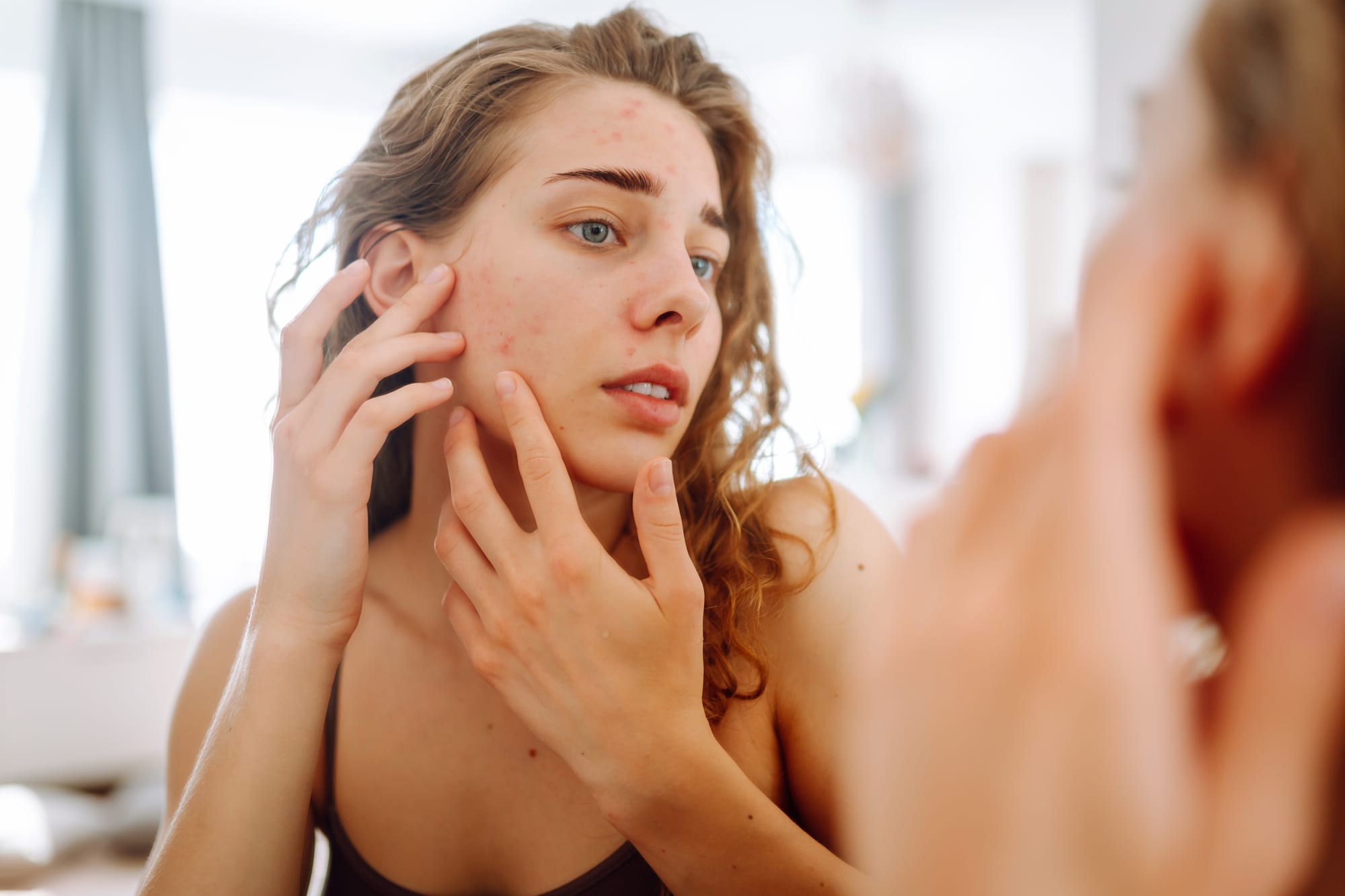 Understanding Skin Health: Why It Matters