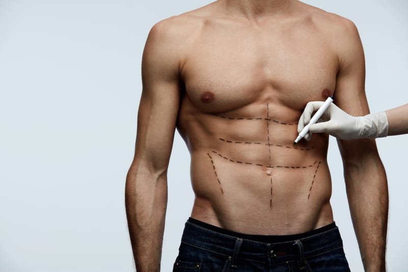 Six Pack Surgery