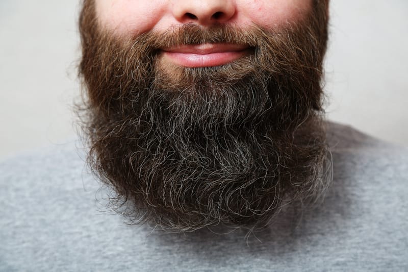 Beard and Mustache Transplant