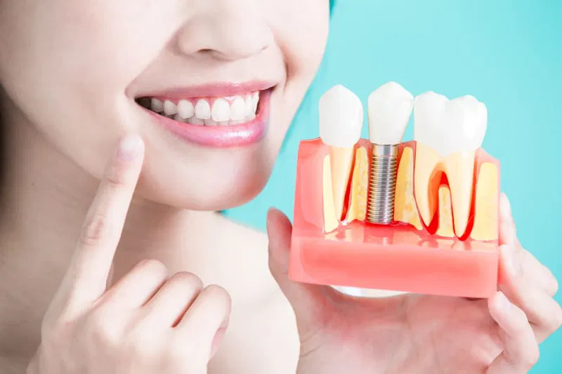 Cosmetic dental implants