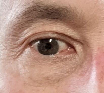 Introduction to Eye Care (online)