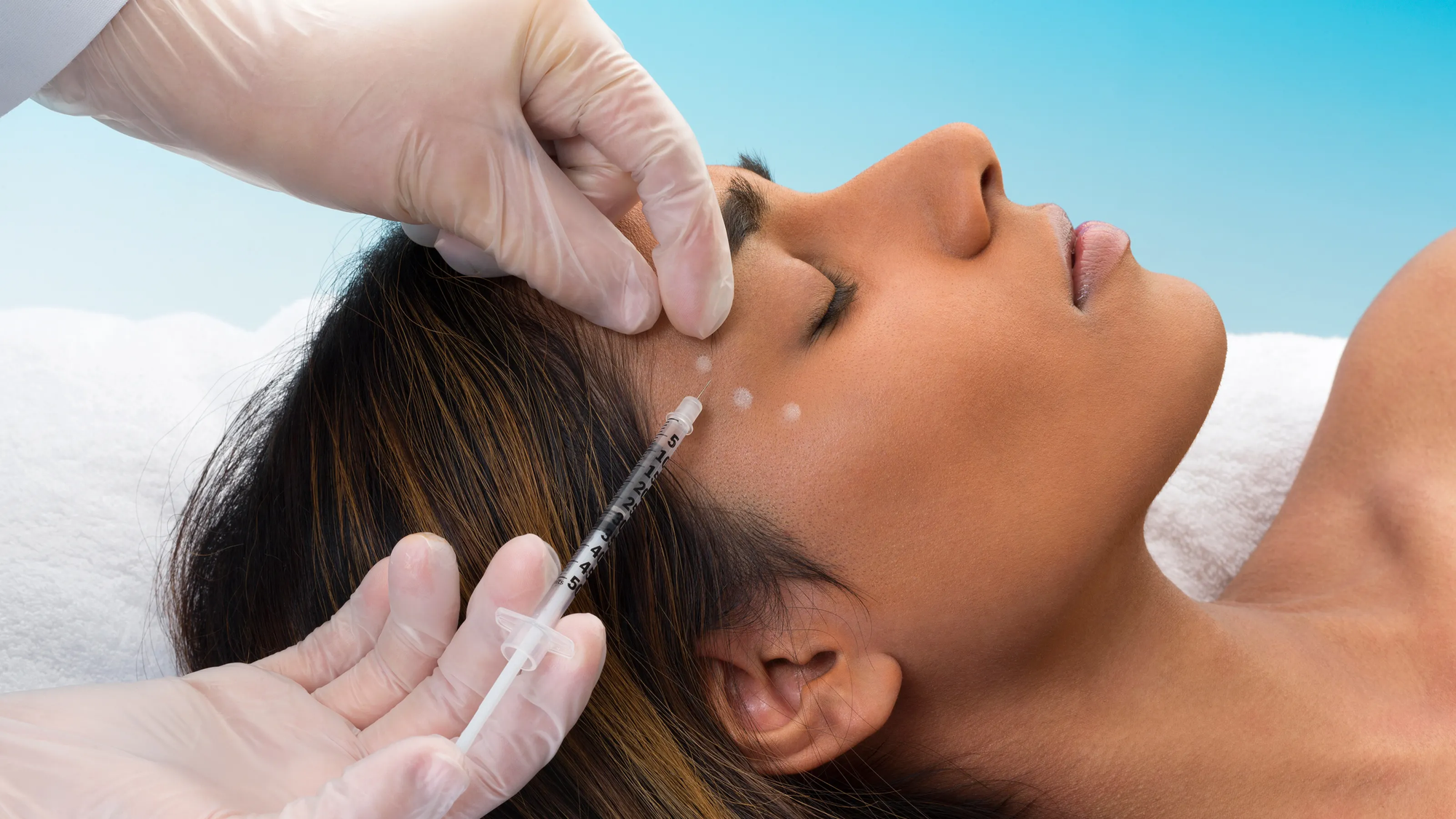 How Long Does Botox in Dubai Last for Facial Rejuvenation?