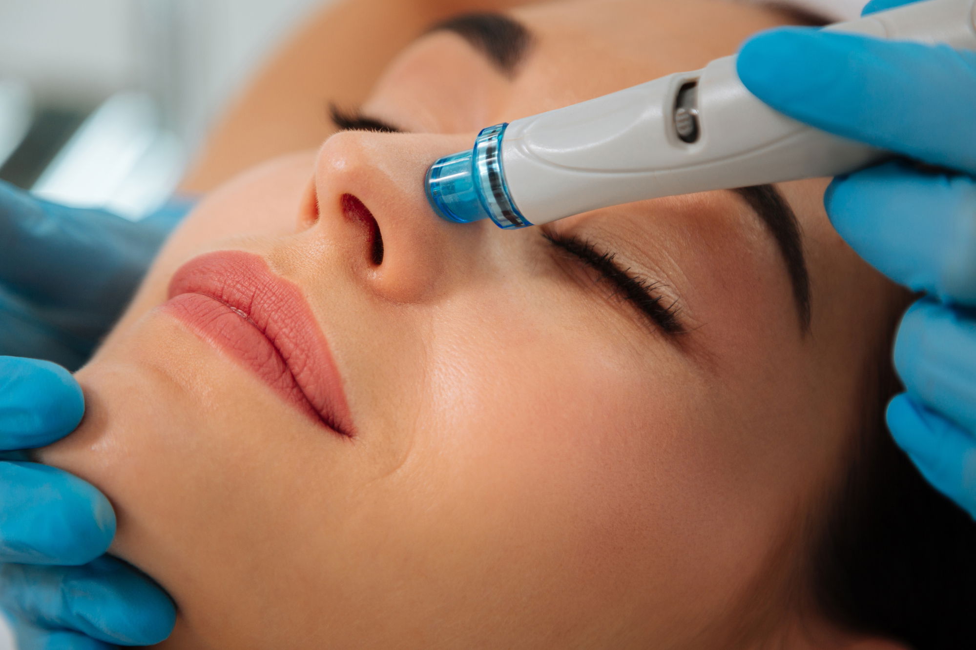 Hydrafacial in Dubai: The Glow-Up Your Skin Will Love