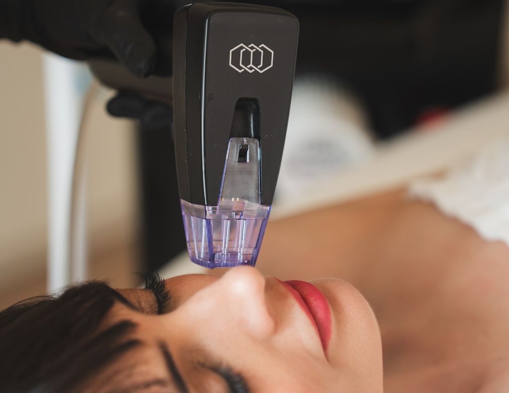 This Skin Tightening Game-Changer Is Morpheus8 Treatment