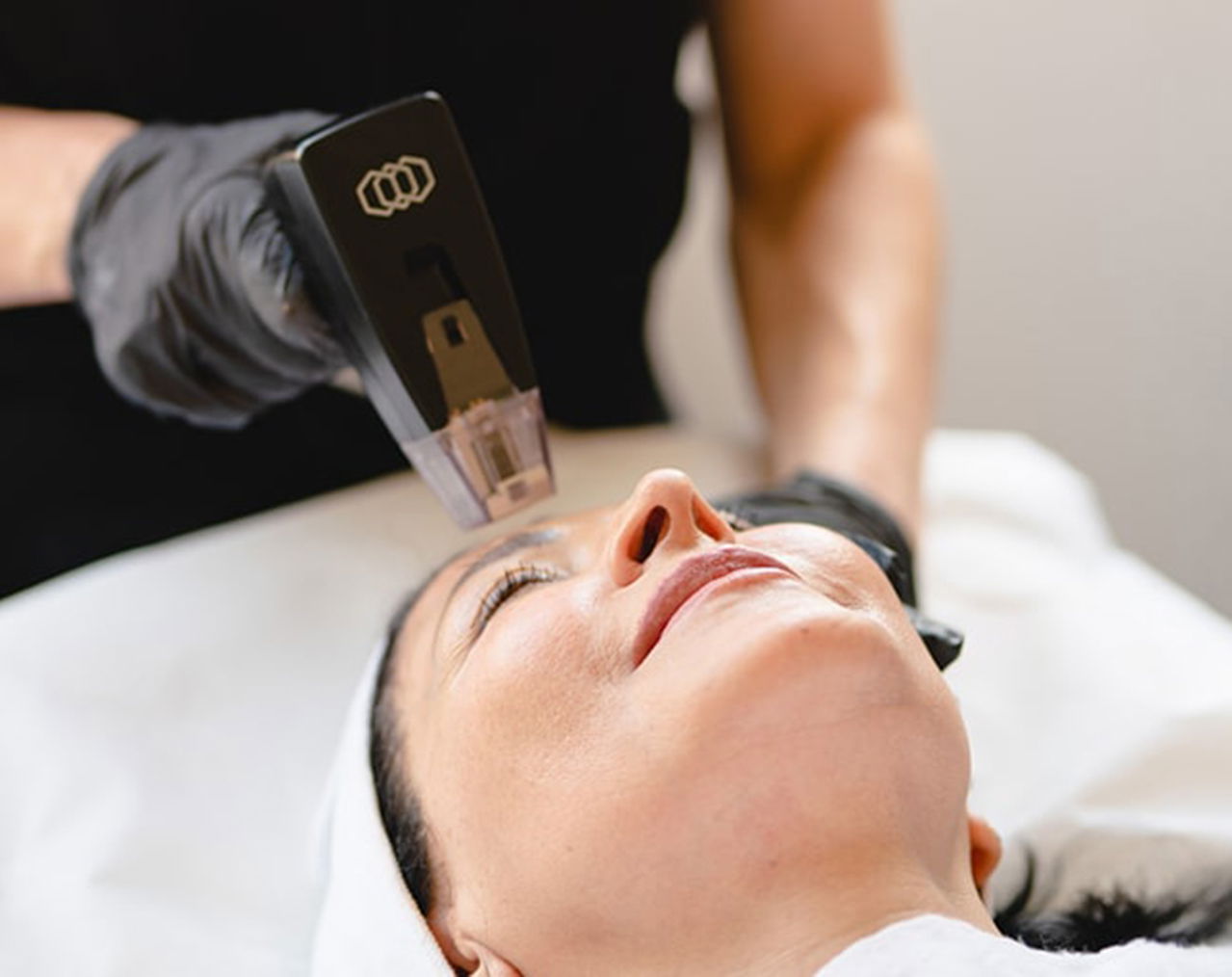 Morpheus8 Treatment Reveals Tighter, More Radiant Skin Today