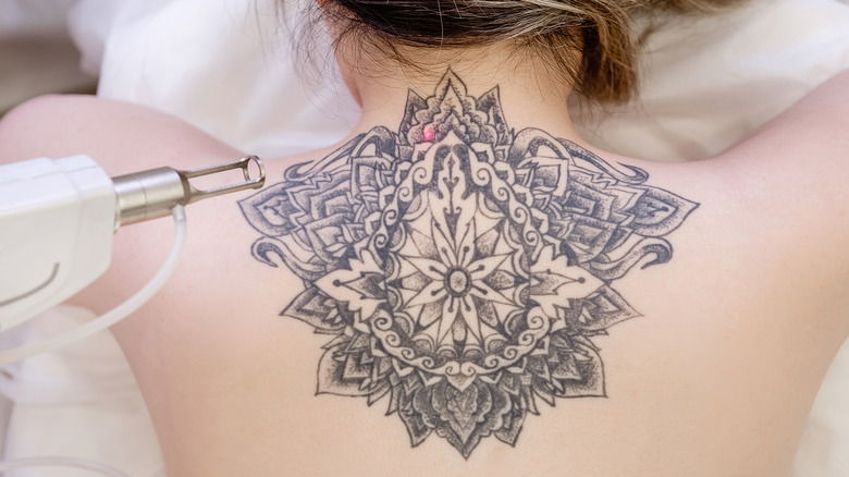 Benefits of Laser Tattoo Removal for People with Sensitive Skin Types