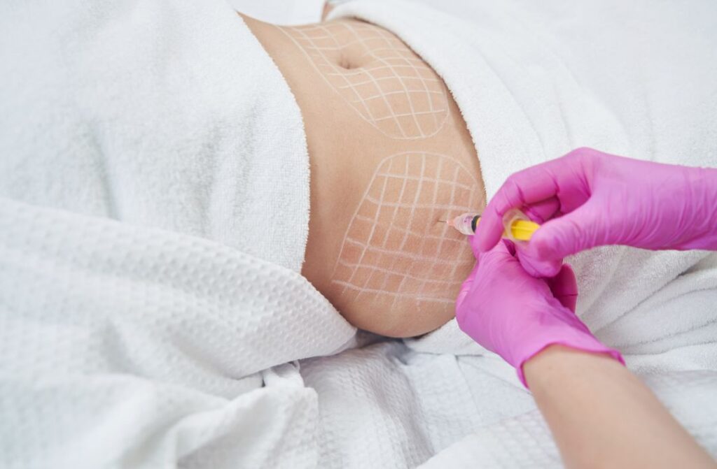 Benefits of Fat Melting Injections for Reducing Excess Fat Safely