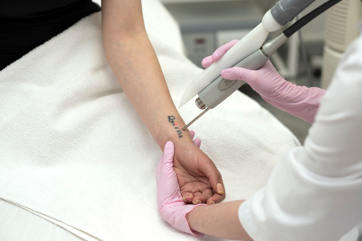 Explore the Long-Term Benefits of Laser Tattoo Removal Treatments