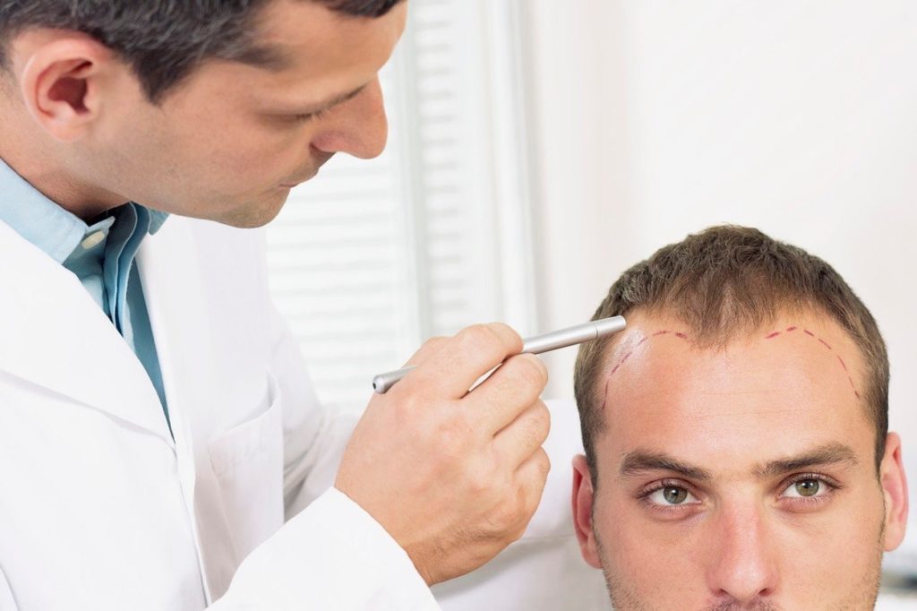 Hair Transplant in Dubai Is the Fix for Thinning Hair Woes