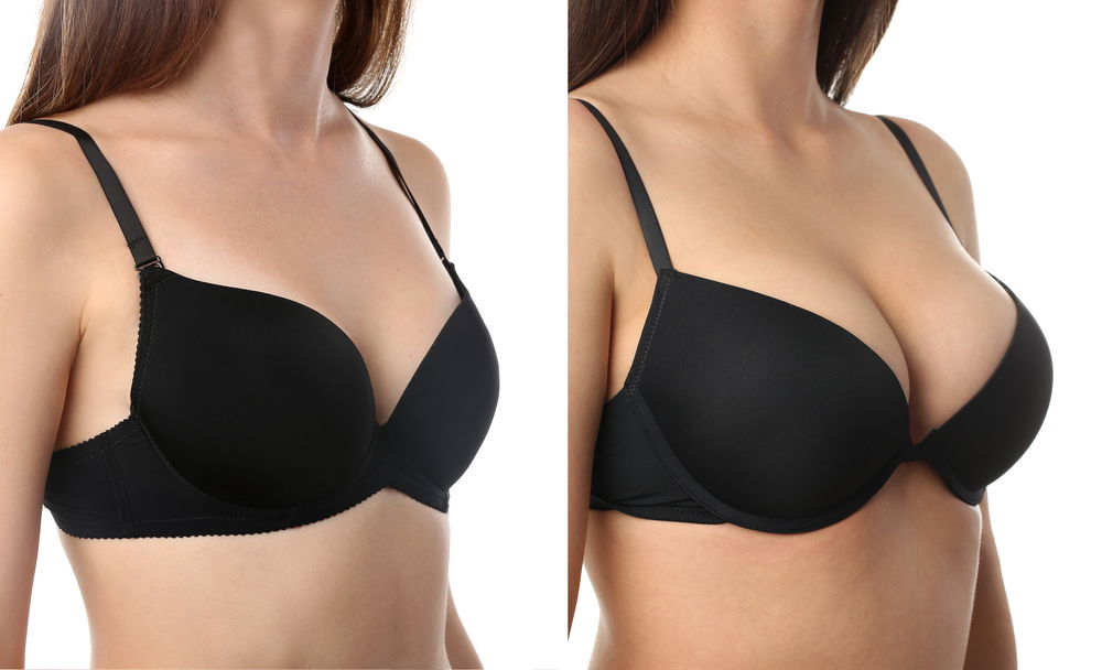 Create Your Dream Look with Breast Augmentation in Dubai