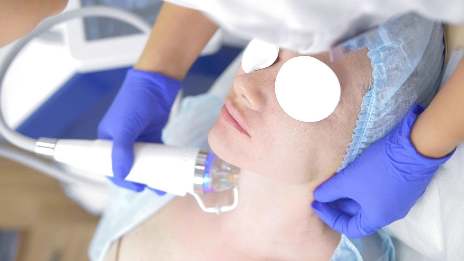 Say Yes to Glow with Fractional RF Microneedling Support