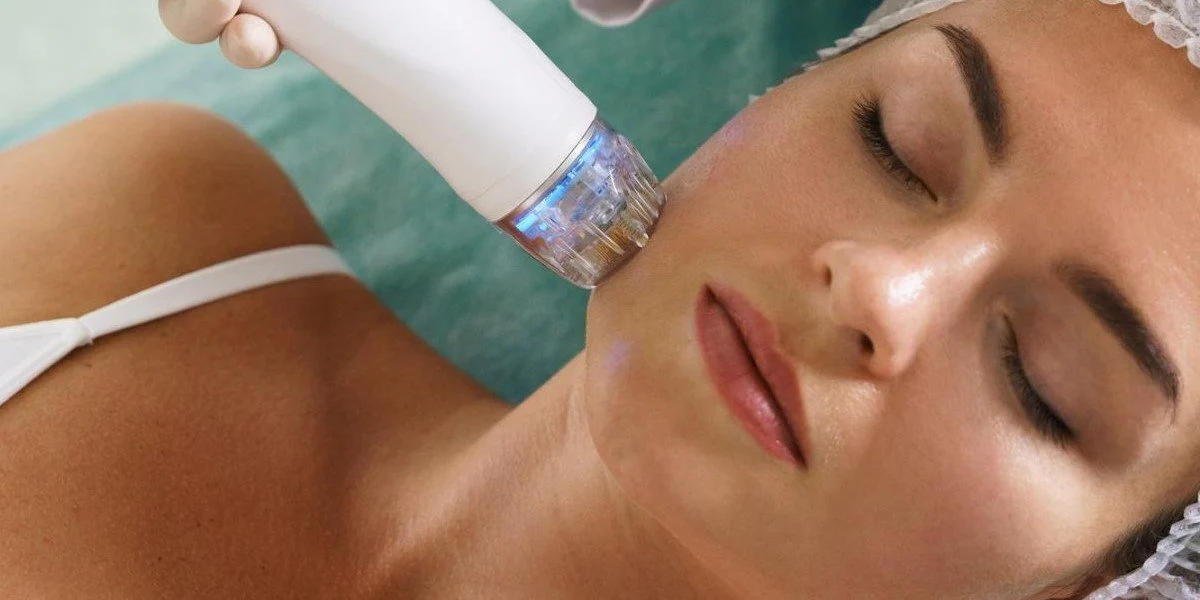Youth Boost Starts with Fractional RF Microneedling Dubai
