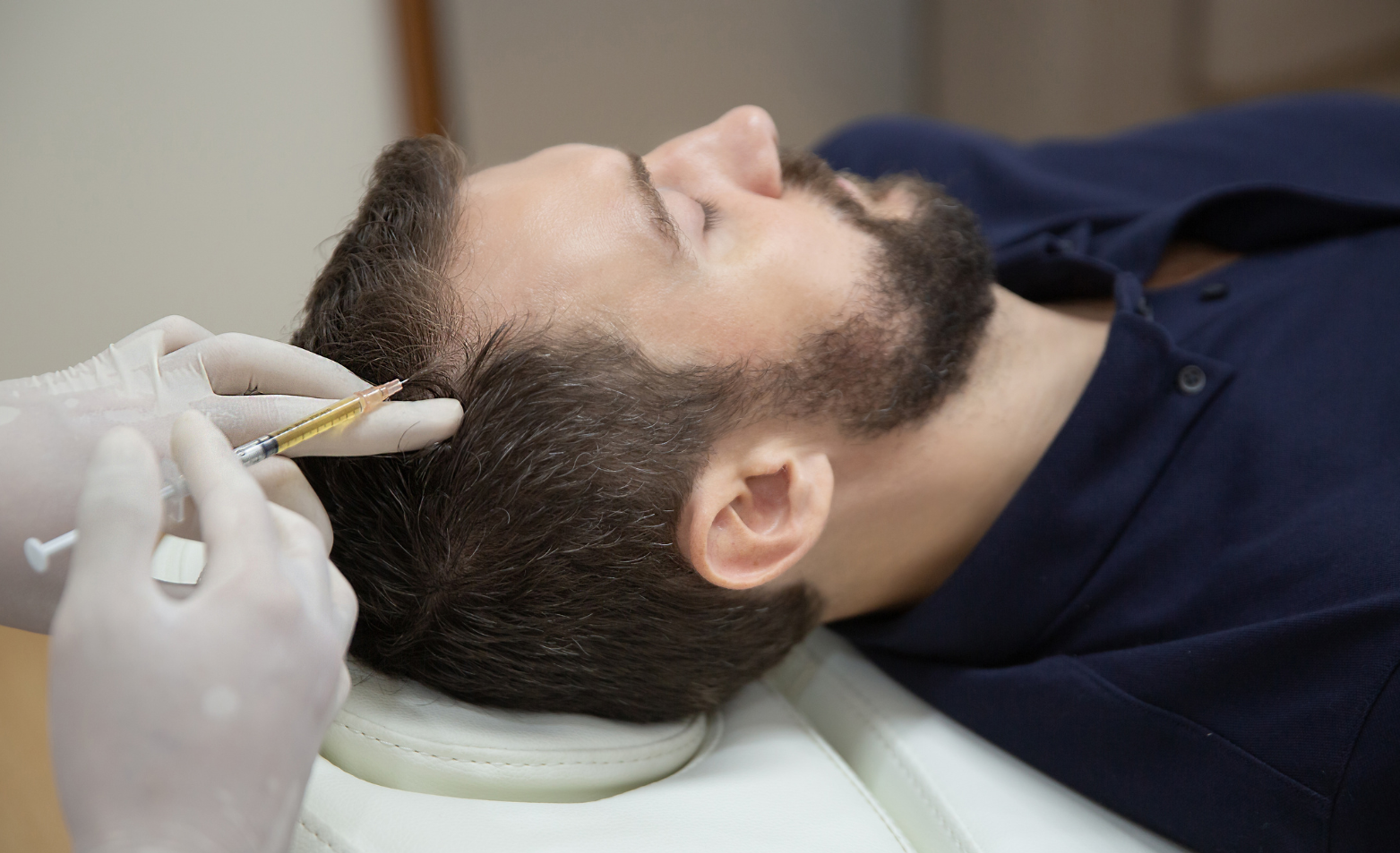 Hair Loss Treatment in Dubai Builds Dense Hair Future