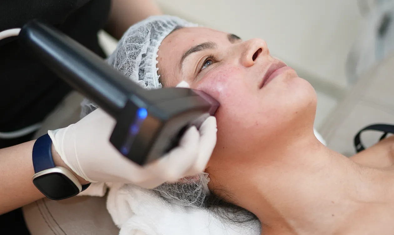 Morpheus8 Treatment Dubai for Skin That Always Slays