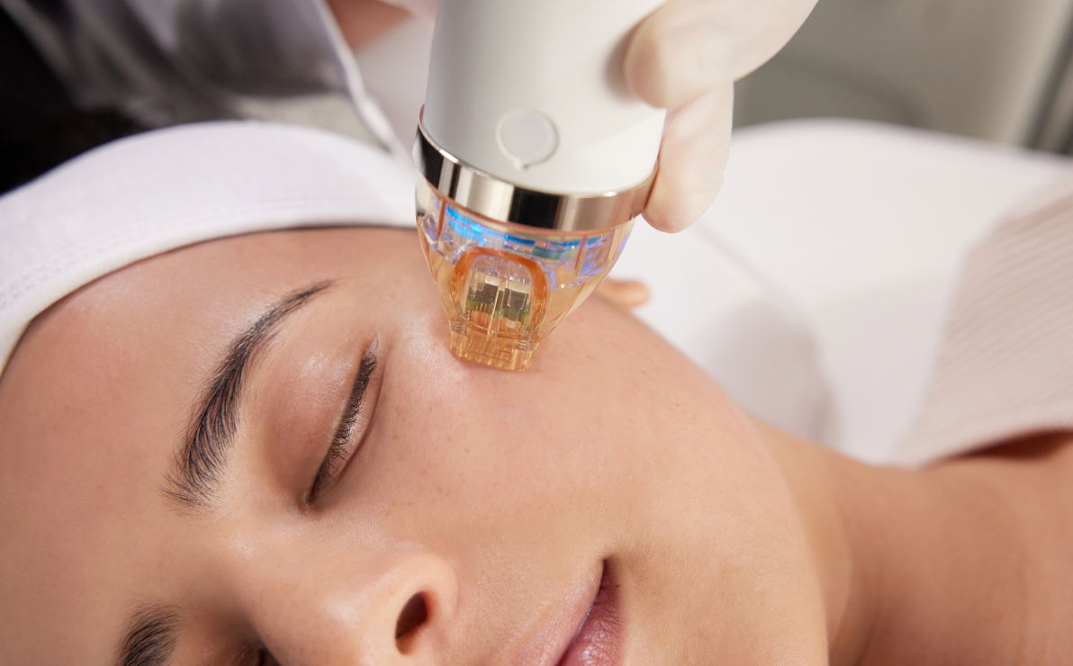Can Fractional RF Microneedling Tighten Loose and Sagging Skin Effectively?