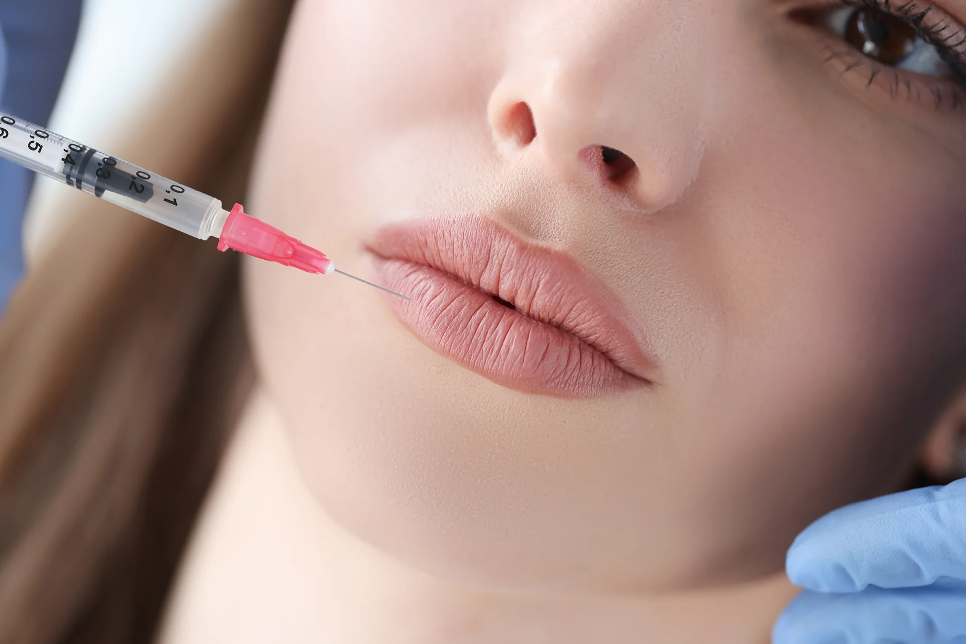 How to Choose the Right Volume for Lip Fillers Injections
