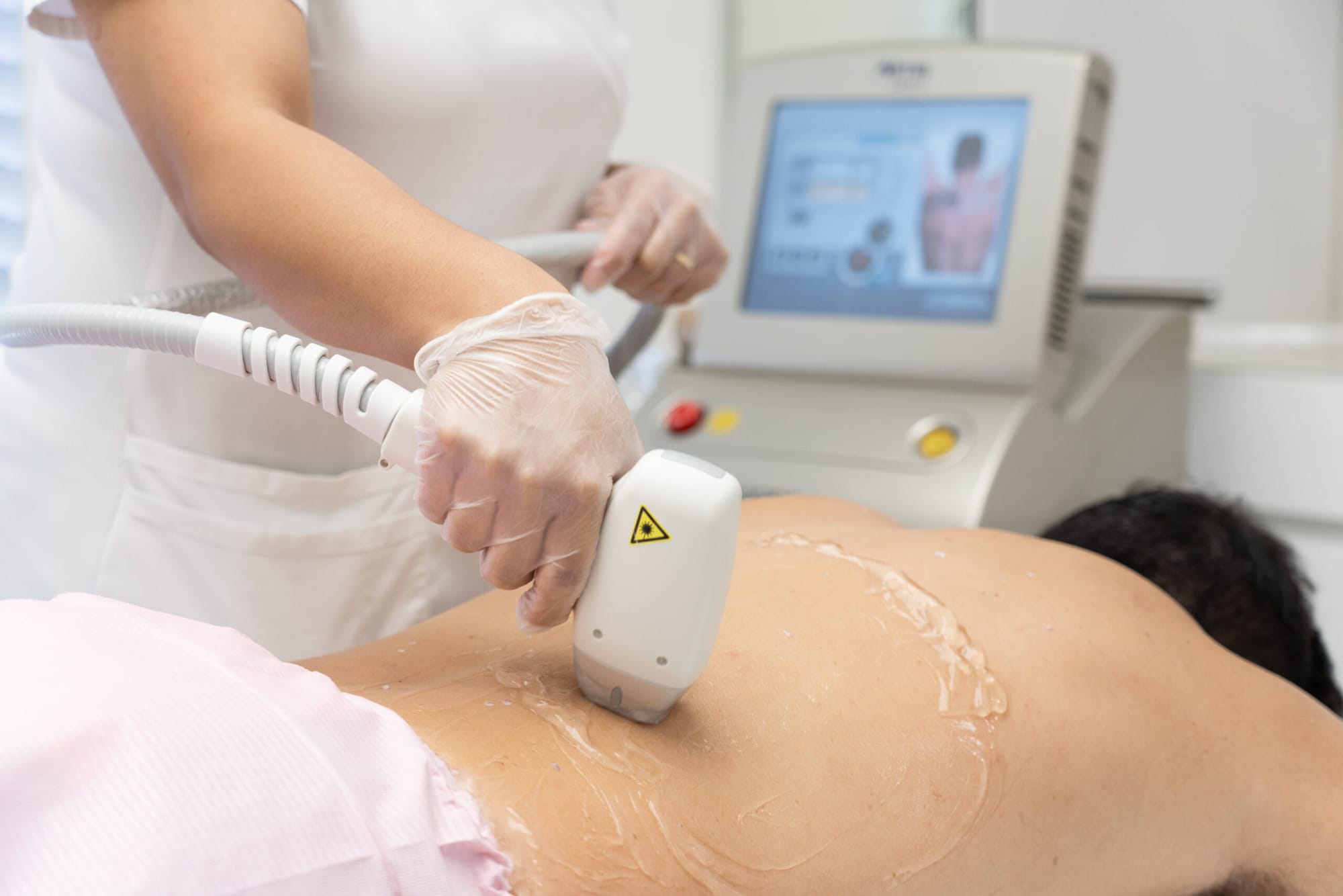 How Can You Get Smooth Skin Fast With Laser Hair Removal Methods?