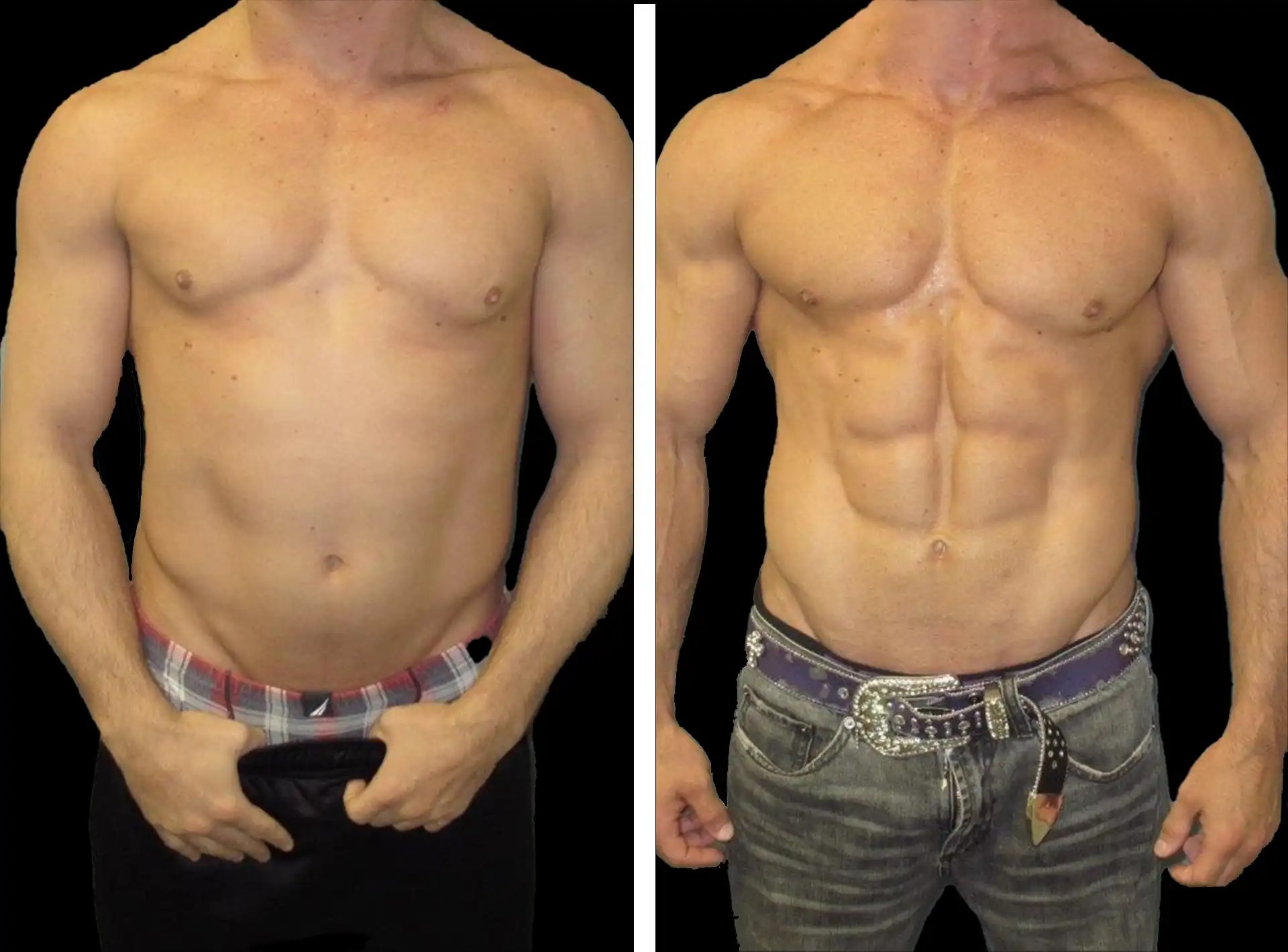 Clinics Recognized for Six-Pack Abs Procedures in Dubai