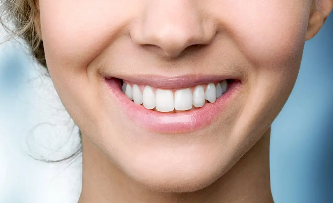 Achieve a Brighter Smile with Dubai's Teeth Whitening Experts