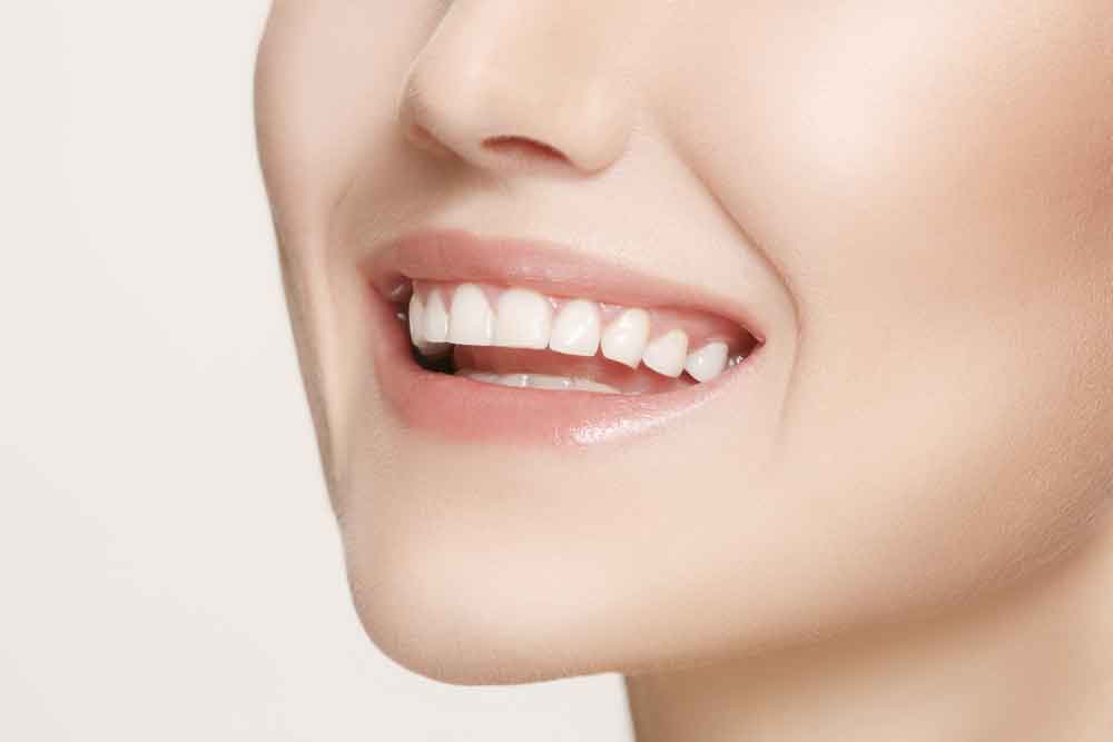 Revealing Brighter Smiles: Teeth Whitening in Dubai