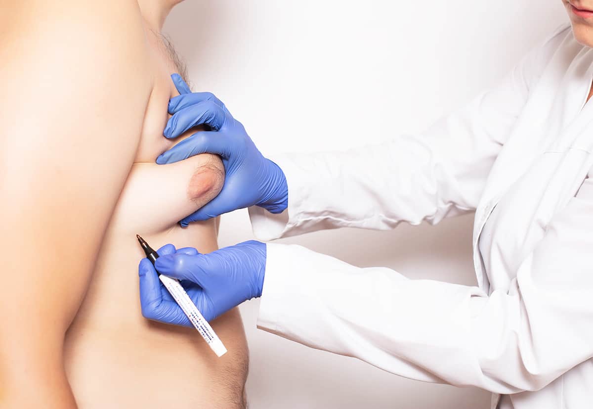 Get Rid of Male Breast Enlargement with Surgery