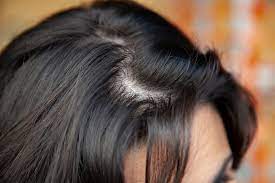 The Benefits of Finasteride for Dubai Residents: A Comprehensive Guide