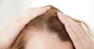 How Does Finasteride Work in Dubai?
