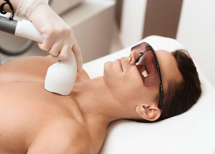 Halal Beauty: Is Laser Hair Removal Permitted?