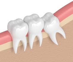 Understanding Tooth Extraction Expenses Today