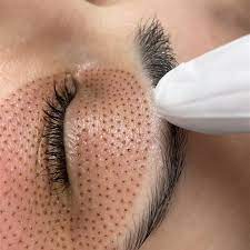 Get Glowing Skin with Plasma Pen Treatment