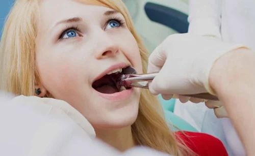 Understanding the Process of Tooth Extraction