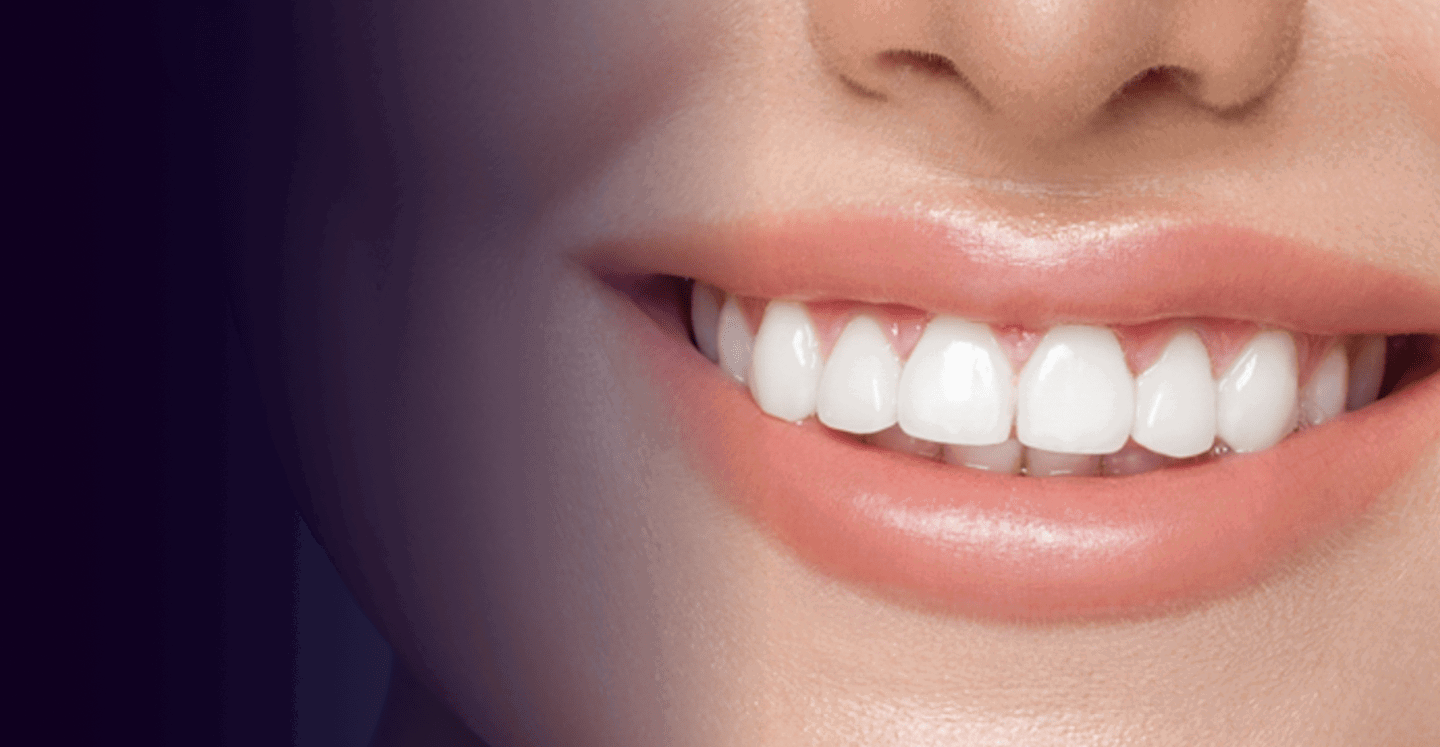 Pros and Cons of Teeth Whitening Cost in Dubai